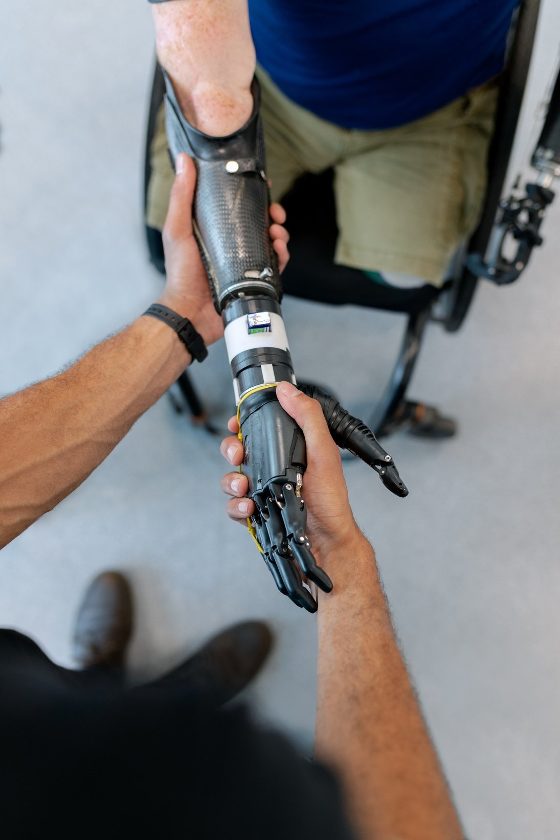 Person Holding Prosthetic Arm